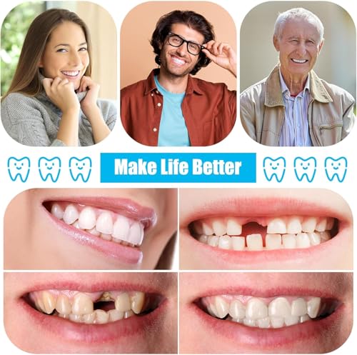 BJDTY DIY Denture Combinations, Making Partial dentures and Full dentures kit DIY Simulation Practice Making dentures, Equipped with Tool kit and Temporary Teeth (Dental Wax) (3) 3