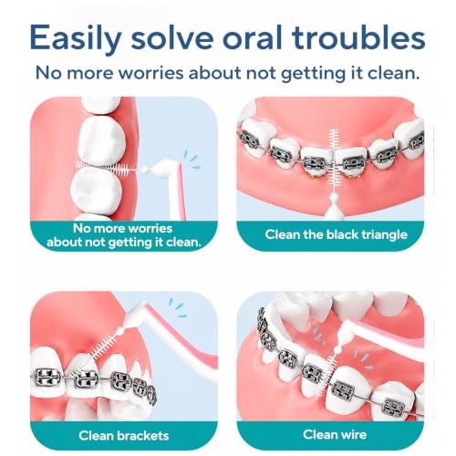 DR.CLEAN Angled Interdental Brushes 0.9mm for Tight Teeth Gaps, L-Shaped Interproximal Brush for Braces, Interproximal Brush for Back Teeth (12 Boxes / 60 Pieces) 12 Boxes / 60 Pieces)