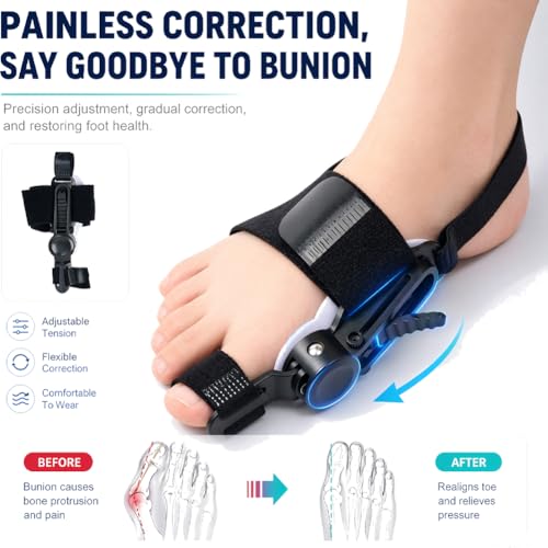 Bunion Corrector for Women & Men, Big Toe Splint with Gel Toe Spacers, Hallux Valgus Brace for Pain Relief & Toe Alignment, Suitable for both left and right feet, Day & Night Wearable White