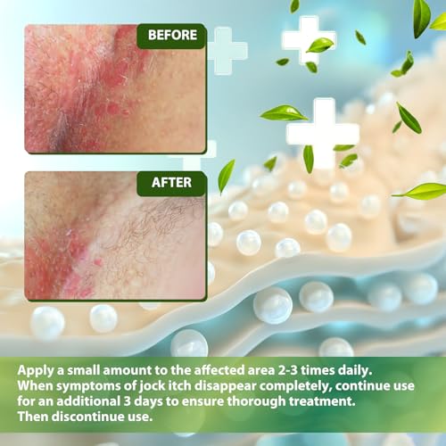 Recuren Plus Jock Itch Antifungal Skin Cream: Tea Tree Oil Anti Fungal Cream with Aloe Vera, Lavender & Eucalyptus – Extra Strength Herbal Moisturizer for Itchy Skin Soothing– for Men & Women, 30g