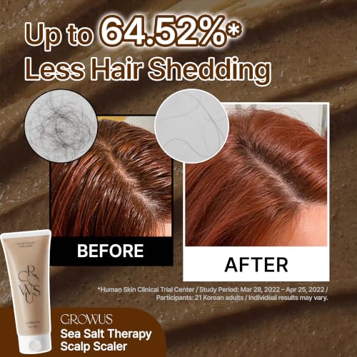 GROWUS Sea Salt Scalp Exfoliator Scrub - Salicylic Acid, Niacinamide, Dexpanthenol, Exfoliating, Deep Cleansing for Itchy, Oily, Greasy Roots and Scalp, No Paraben and Sulfate (8.8 Oz / 250g) 8.8 Ounce (Pack of 1)