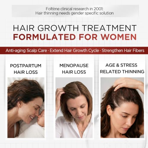 Foltene Italian Hair Growth Serum for Women, Clinically Proven, 12 Vials