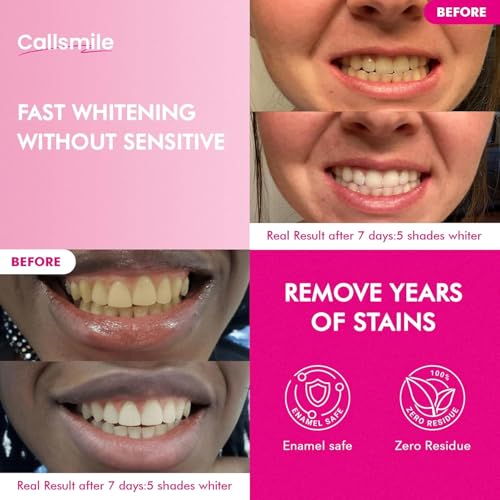 CALLSMILE Whitening Strips for Teeth Sensitive: 64 Strips Gentle Teeth Whitening Strips Enamel Safe Non-Slip Dry Strip Technology Residue Free Daily Oral Care, Mint Mint+Mint sea salt 64 Count (Pack of 1)