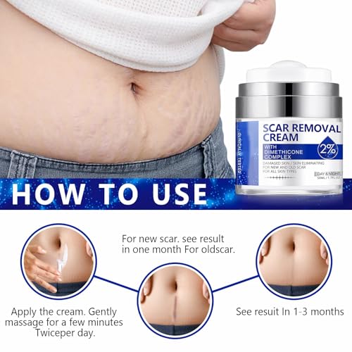 Scar Cream, Scar Removal Cream - Advanced Scar Cream for Surgical Scars, Acne Scars, C-Section, Burns, Stretch Marks -Effective for Old and New Scars Gel Acne Scar Treatment