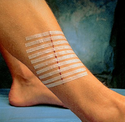 3M Steri-Strip™ Skin Closures, Reinforced, 1/4" x 1 1/2", 6/Pk, 50Pks/Bx