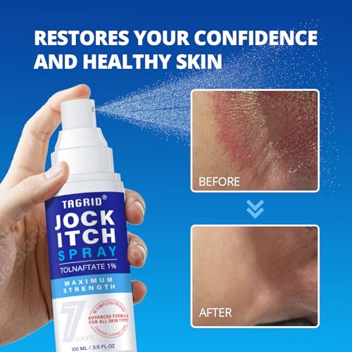 TAGRID Jock Itch Spray: Maximun Strength Jock Itch Treatment fot Itch Skin Relief - Antifungal Anti Itch Spray for Men Women Skin (3.5 Fl Oz (Pack of 1)) 3.5 Fl Oz (Pack of 1)