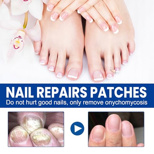 Fungal Nail Patches 60 Pcs,Upgraded Toe Nail Fungus Treatments 60 Count (Pack of 1)