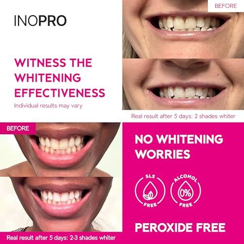 InoPro Teeth Whitening Strips 21 Treatments Kit + InoPro Whitening Hydroxyapatite Toothpaste with Probiotic for Sensitive Teeth 5oz