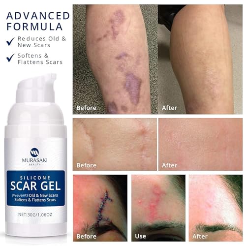 100% Silicone Scar Gel 2 Pack: 2 x 1.06oz Tubes for Surgical Scars, C-Section, Acne, Keloids, Burns, Stretch Marks – Advanced Scar Treatment for Old & New Scars 2 Count (Pack of 2)