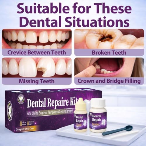 Dental Care Kit Zinc Oxide Eugenol Cement, Temporary Tooth Repair Kit for Crowns Filling, Temporary Teeth Fix for Confident Smile Purple