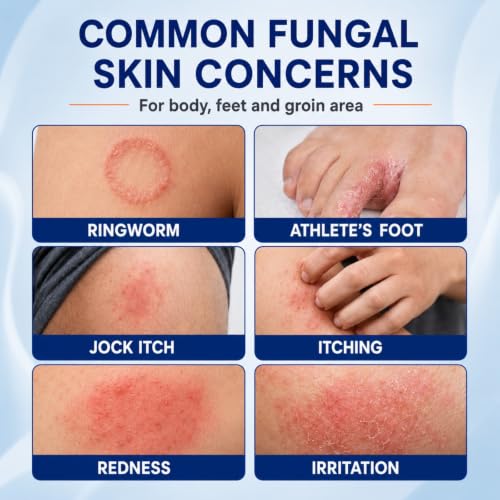 Antifungal Ringworm Treatment Cream, Miconazole Nitrate 2%, 3.53 oz