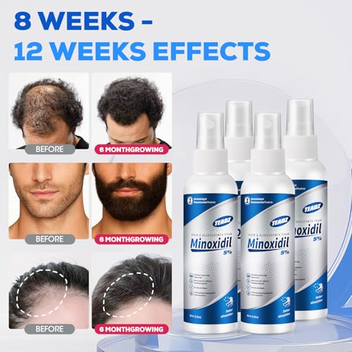 5% Minoxidil for Men and Women，Minoxidil hair growth products，Intense Hair Growth Serum，May Promote Faster, Stronger, Thicker Hair Growth to Fight Hair Loss and Thinning Hair（2.82 oz*4) 2.82 Count (Pack of 4)