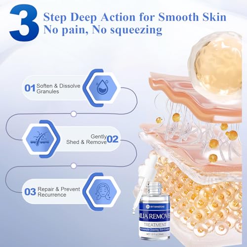 Milia Remover for Face & Eyelids, Milia Remover Treatment with 1% Salicylic Acid for Acne, Milia Removal Serum for Men & Women