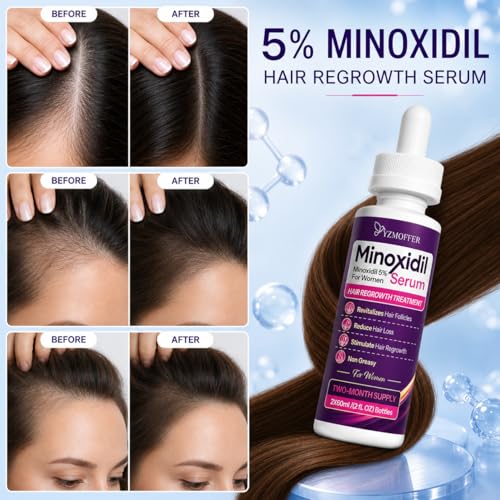 Minoxidil 5% Hair Regrowth Treatment for Women, 2-Month Supply 2.03 Fl Oz (Pack of 2)