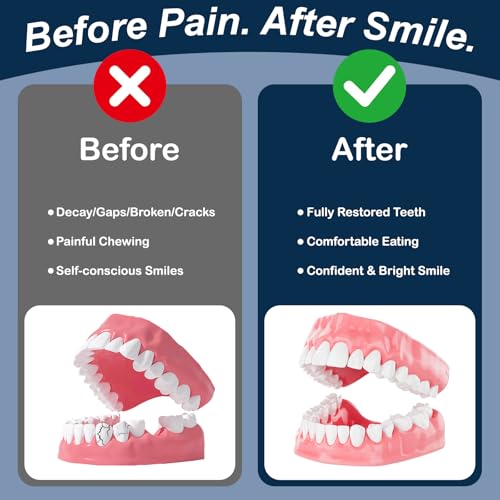 Dental Lab Denture Repair Glue (1oz) - Fast-Setting, Instant Bonding Adhesive for Broken Dentures and Teeth Repair - Strong Bond for Securely Fixing Cracks Instantly Lasting Days to Weeks