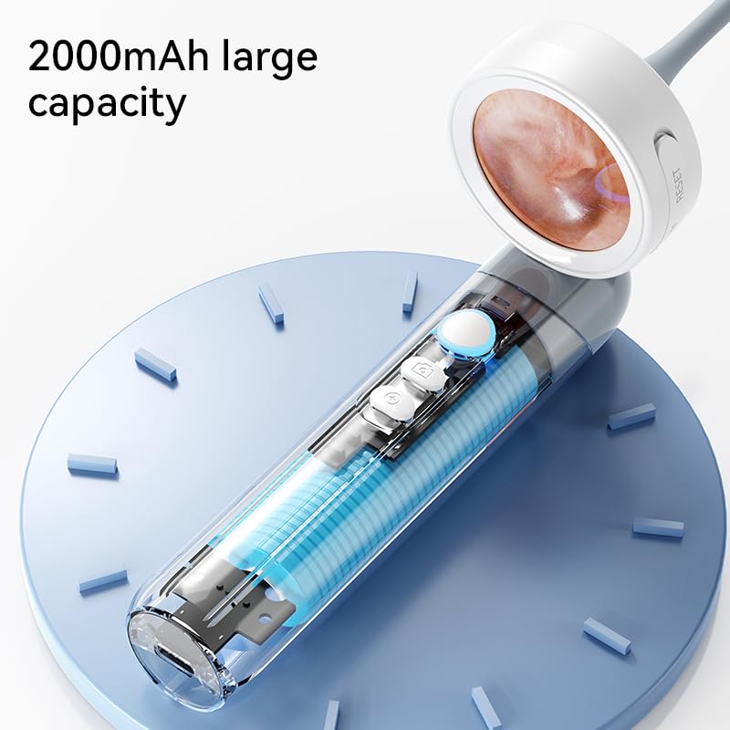 Smart Ear Camera with Screen, 2MP HD Otoscope, 90° Rotating Head, 1.38" Display, 12 Specula Tips, Photo & Video Function - BeesActive Australia