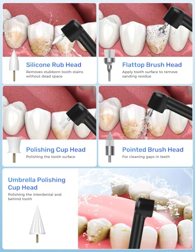 Rechargeable Tooth Polisher, Teeth Polishing Kit for Teeth Whitening, Tooth Polisher for Tartar Stain Removal, Teeth Cleaner Tools for Home Use with 3 Polish Paste and 5 Brush Heads, LED Light
