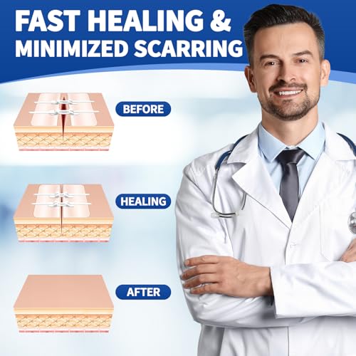 Emergency Wound Closure Strips Kit, 3 Types Butterfly Bandages, Laceration Closure Kit with Cleaning Wipes, Stitchless Wound Closures Device for First Aid (Mix 52Pack) Mix 52Pack