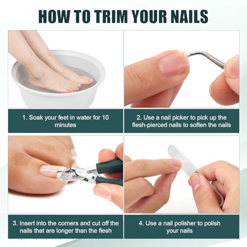 3pcs Ingrown Toenail Clippers Set, Professional Slanted Beveled Eagle Beak Curved Nail Clippers with File & Tear Tool for Thick Nails & Seniors (Green) Green, Silver