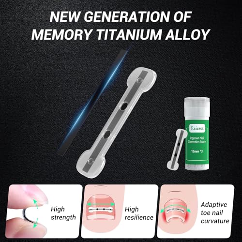 Titanium Alloy Ingrown Toenail Treatment, NailTools, and Ingrown Toenail Removal Kit SpeciallyDesigned for Curved Nail Repair and Ingrown ToenailCorrector (0.59/0.67in) 0.59/0.67in