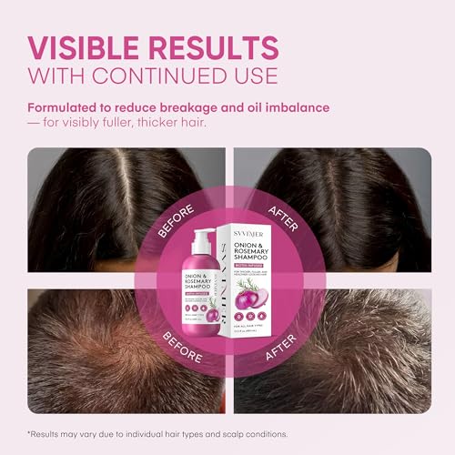 Svvimer Onion Rosemary and Biotin Shampoo - Hair Growth Shampoo for Hair Loss and Thinning Hair - Thickening and Strengthening Formula for Men and Women - 13.5 Fl Oz (Pack of 1) 13.5 Count (Pack of 1)