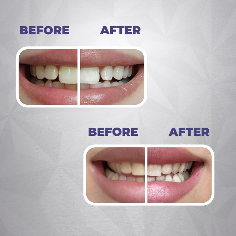 Gentle Whitening & Remineralization Teeth Strips | Helps Your Teeth gets Stronger | 14-Treatment Kit for Sensitive Teeth | Peroxide-Free Formula with Hydroxyapatite, Papain & Coconut Oil (28 Strips)