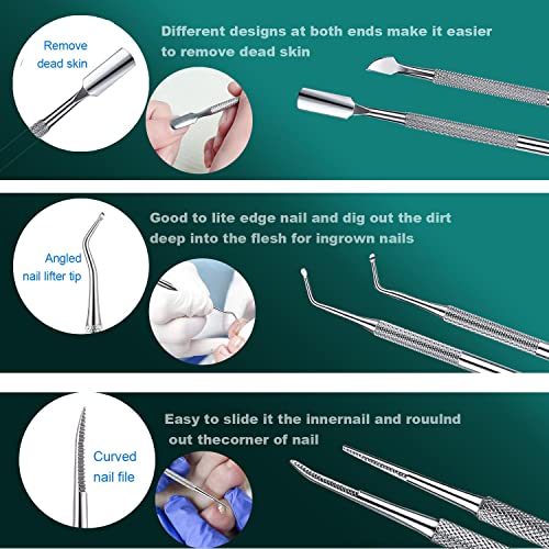 6pcs Ingrown toenail Tool, Toenail File and Lifters Natural color