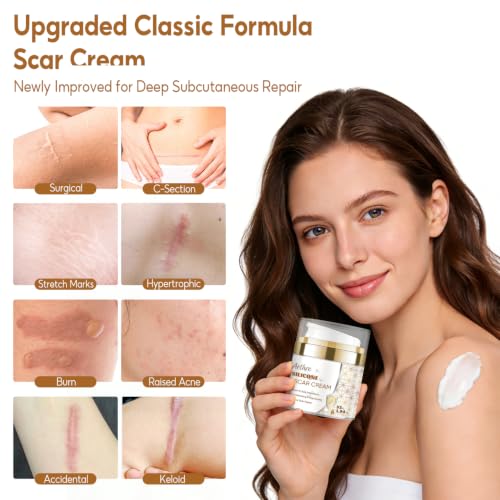 Advanced Silicone Scar Gel Cream, Professional Scar Removal Treatment for C-Section Surgery, Injury, Acne, Burn, Keloid & Stretch Marks, Works on Both Old and New Scars, 55g (1.94 Oz)