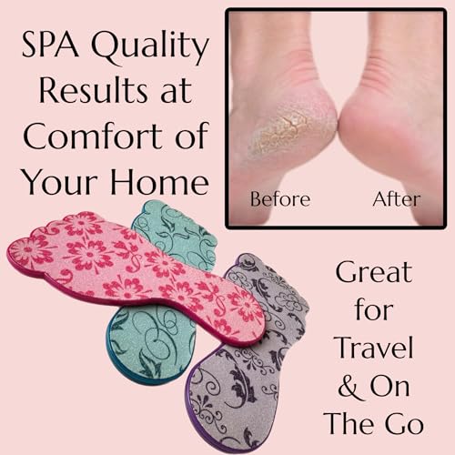 3pc ALAZCO Foot File Callus Remover for Feet Heel Scraper Pumice Stone Diabetic Feet Scrubber Dead Skin Remover Salon SPA DIY & Professional Pedicure Tools Washable TSA & Travel Friendly