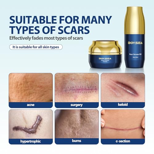 Boysea Scar Cream & Serum Oil, Advanced Scar Removal Set, Reduces Appearance of Keloids, C-Sections, Surgeries, Burns, Acne, 2 x 1.06 Oz Bottles