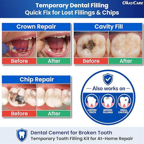Zinc Oxide Eugenol Dental Cement Kit – Instant Tooth Repair, Cap, Crown & Bridge Filling | Ultra Strong & Pulp-Soothing Formula | Long Lasting - Easy Mix-and-Use Dental Adhesive for DIY, Home & Clinic