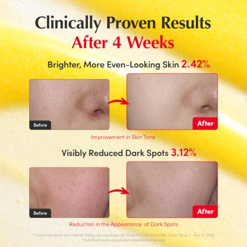 EQQUALBERRY Vitamin Illuminating Serum Double Pack | Niacinamide 4% & TXA | Brightening Vitamin C Serum for Glow & Hyaluronic Acid | Dark Spot & Uneven Tone Care | Korean Skincare, 1.01 oz (Pack of 2) 2 Pack 1.01 Fl Oz (Pack of 2)