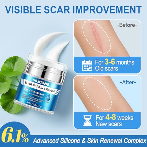 Scar Cream with 6% Dimethicone Formula & Scar Tape Set 1.69 Fl Oz (Pack of 1)