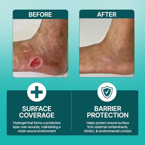 SiloVance Antibacterial Wound Dressing Gel with Silver Nano Tech, First Aid 4 Pack 1 Ounce