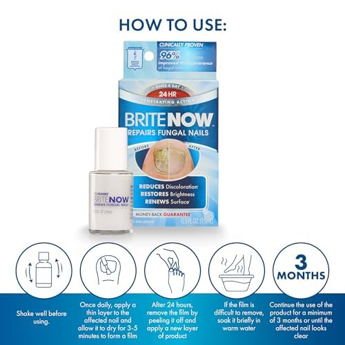 Brite Now Nail Treatment, Restores The Appearance Of Damaged & Discolored Nails, Peel-Away Technology, Brightening & Smoothing Nail Repair, 0.5 Ounce