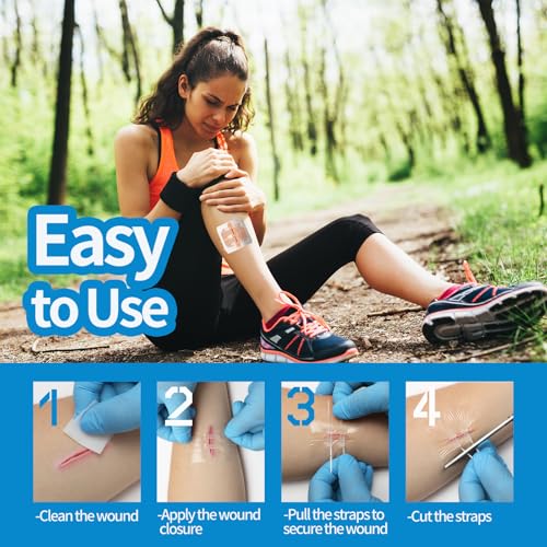 Emergency Laceration Closures, Zipstitch Wound Closure Device (4 Set) - 2 Types Laceration Repair Without Stitches, Easy to Use Wound Closure Kit for Home, Outdoors 4 Set (Mixed)