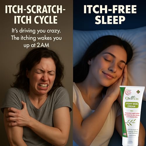 Oleavicin Extra Strength Anti-Itch Cream - Itchy Skin Cream for Fast Itch Relief - Natural Anti Itch Cream for Adults & Kids - Organic Olive Leaf Extract - Steroid-Free Rash Relief for Sensitive Skin 1 Pack