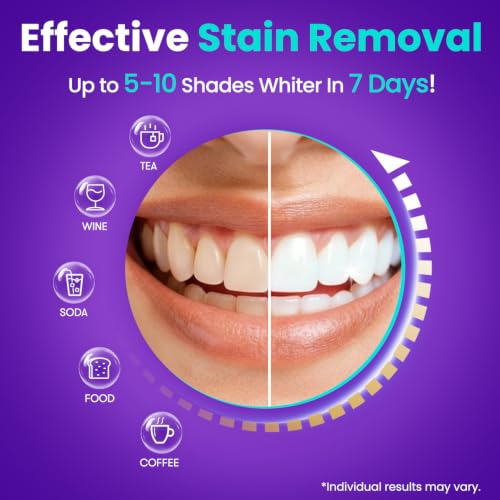 MySmile Teeth Whitening Strips 21 Treatments, Hydroxyapatite-Infused White Strips for Sensitive Teeth, Teeth Whitener with Enamel-Safe Formula, Non-Slip, Residue-Free Whitening Kit, Mint 42 Count (Pack of 1)
