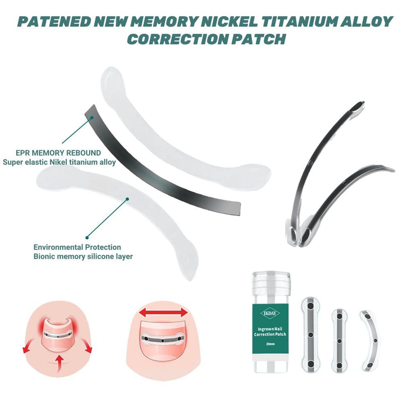 Ingrown Toenail Removal Kit | Titanium Alloy Ingrown Toenail Treatment | Pedicure Tools for Feet, Nail Tools Specially Designed for Curved Nail Repair and Ingrown Toenail Corrector (0.67/0.79in) 0.67/0.79in
