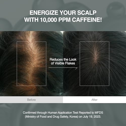Korean Scalpy Hair Growth Serum for Women for Hair Loss & Thinning – Cooling & Refreshing Korean Hair Care For Oily, Lightweight, Treatment, Frizz Ease Serum, Hair loss, Anti Frizz, Hair Mask