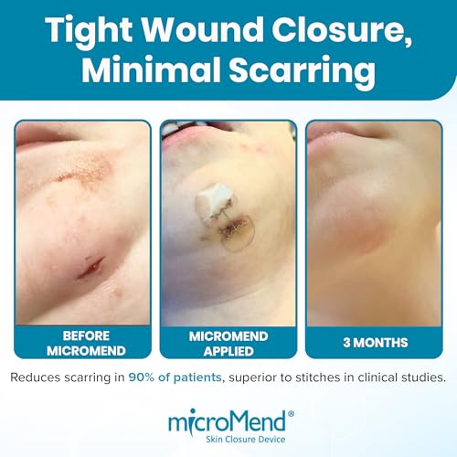 Emergency Wound Closure Kit - 6 Sterile Laceration Strips 6 Closures
