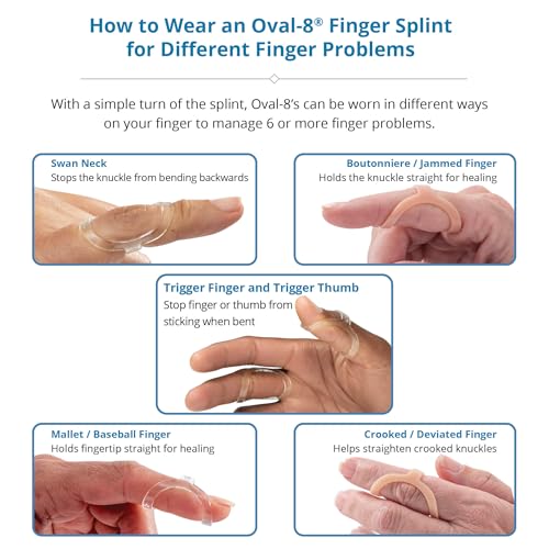 3-Point Products Oval-8 Finger Splint, Size 2, Pack of 5, Beige