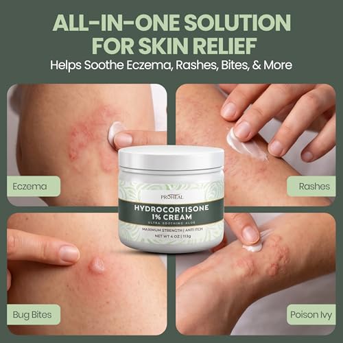 1% Hydrocortisone Cream Maximum Strength with Aloe, 4oz of Anti Itch Cream 4 Ounce