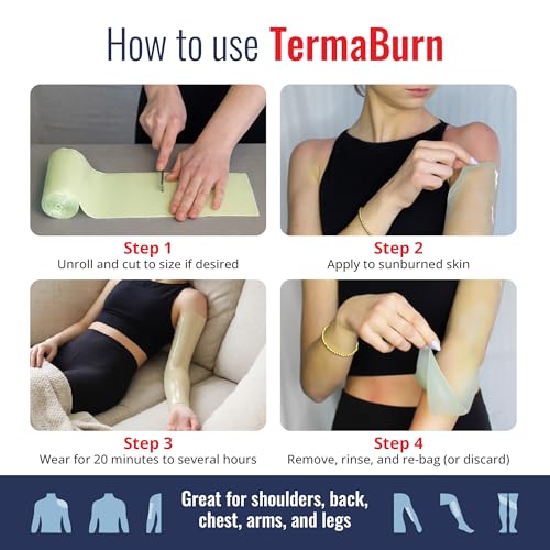 TermaBurn Wearable Aloe Wrap for Sunburn Relief: Hospital-Inspired Hydrogel After-Sun Treatment | Second-Skin Care that Cools, Soothes & Hydrates Dry, Peeling, Irritated Skin