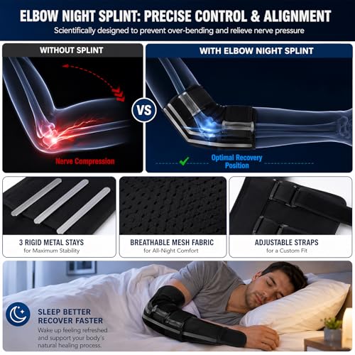 2026 Upgraded Elbow Brace for Cubital Tunnel with Tri-Support & 6 Interchangeable Rods - Ulnar Nerve Support Adjustable Night Splint for Tendonitis, Tennis Elbow for Men & Women