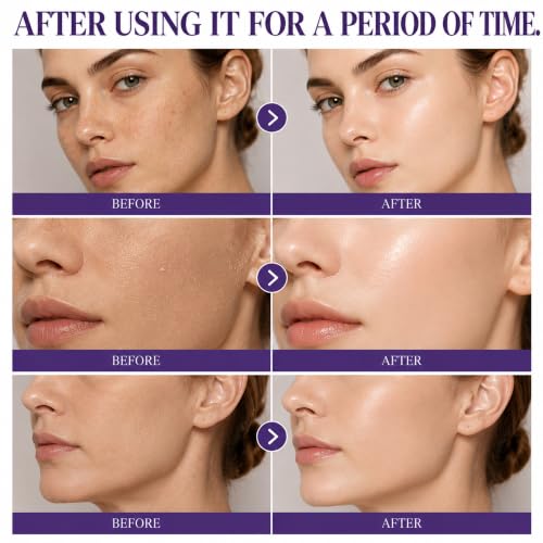 NAD+PDRN Glow Brightening Toner, NAD+PDRN Face Toner, Deeply moisturizes and brightens the Skin, Hydrating Facial Toner for All Skin Types, 5.07 FL OZ, 1 PCS 1pcs 5.07 Fl Oz (Pack of 1)