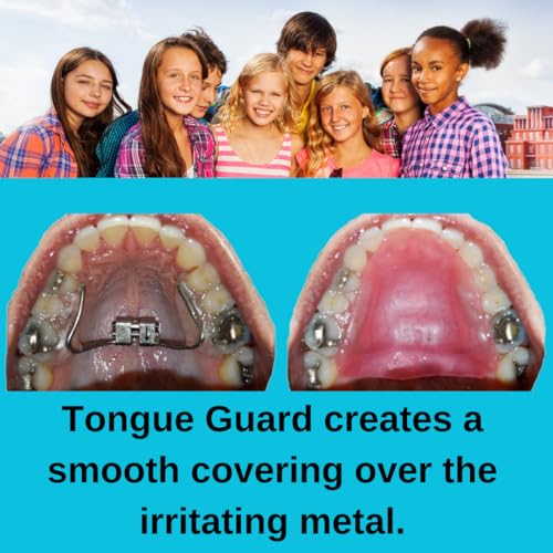 RPE Tongue Guard: Prevents and Helps Heal Tongue Sores Caused by Dental Expanders