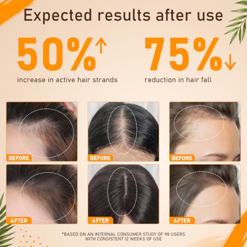 Batana Oil for Hair Growth–100% Pure Unrefined with Rosemary, Castor & Pumpkin Seed Oils, Infused with Biotin | Strengthens, Repairs Scalp, Nourishes & Reduces Hair Loss for Men & Women– 4 oz x 2 Pack