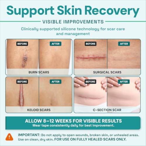 TargetControl Scar Tape for Surgical Scars, Silicone Sheets for Face, 1.2M Aloe Vera 1.2M