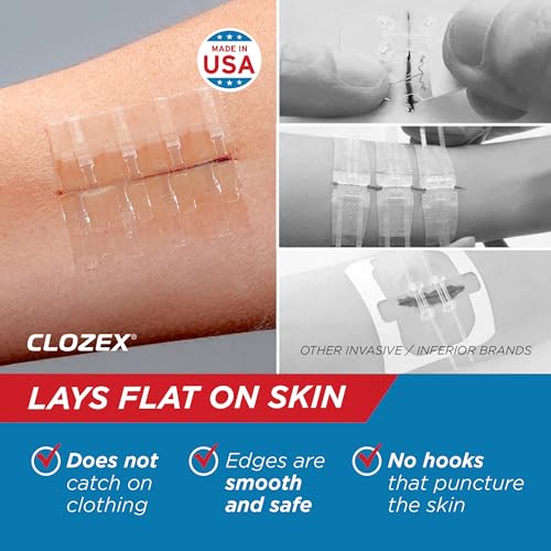 Clozex Emergency Wound Closure Bundle, Skin Closure Device for Laceration Repair Without Stitches – Treat 5 Individual Wounds, Combine for Up to 7 1/4" Total Length